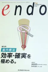 歯内療法 効率・確実を極める
